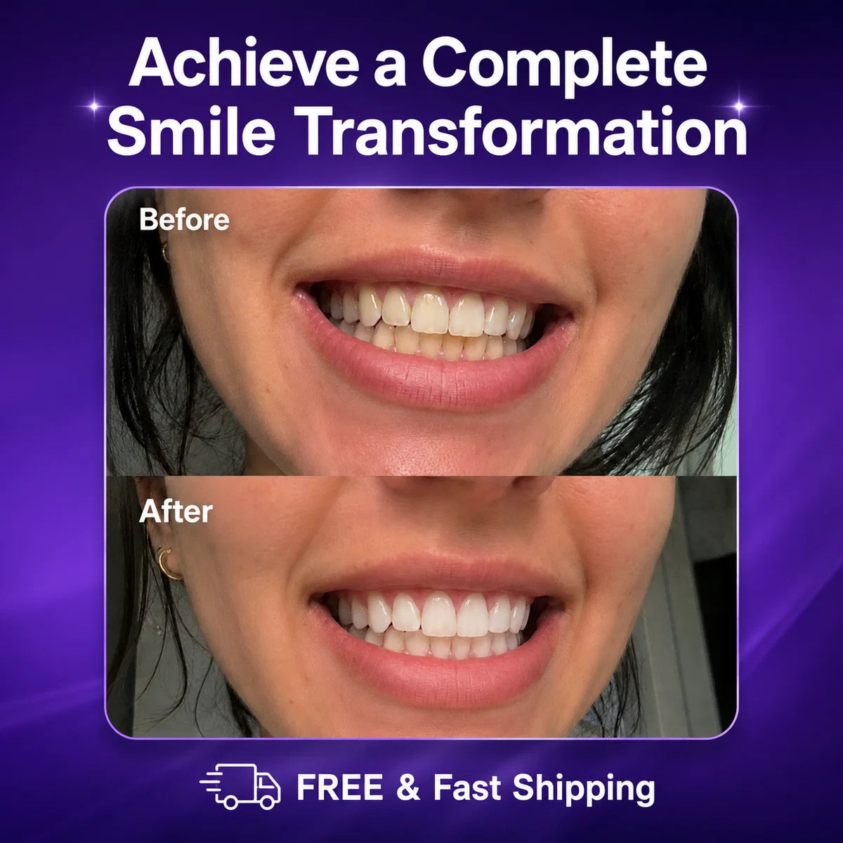 Souq Aura Whitening Strips