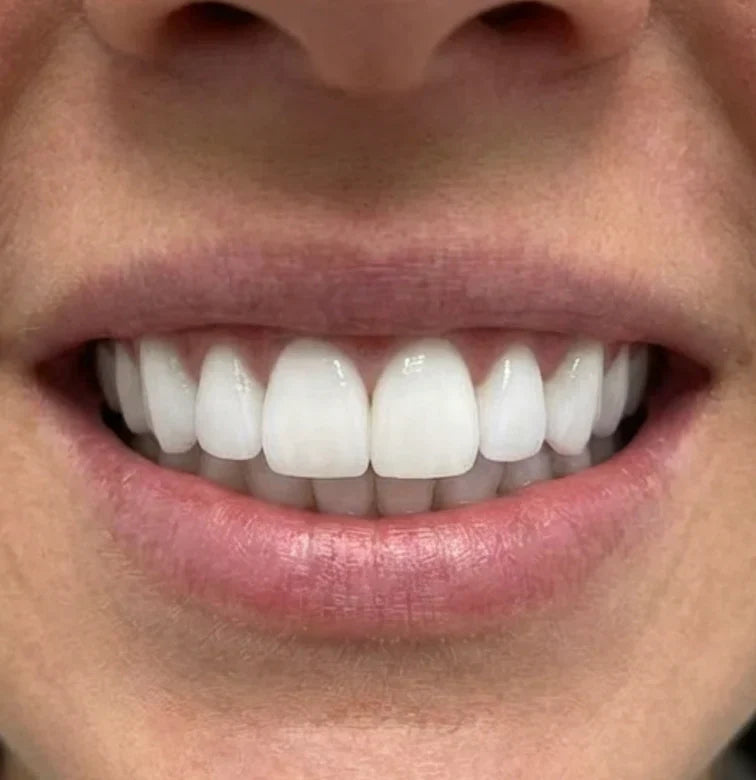 Souq Aura Whitening Strips